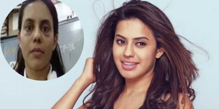 सूजा चेहरा, आंखों के नीचे नीले निशान… कस्टडी में एक्ट्रेस के साथ मारपीट! एक्शन में आया महिला आयोग