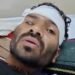 मंडला में बाघ ने युवक पर किया हमला, लाठी से वार कर बचाई जान; हालत स्थिर, मध्य प्रदेश वीडियो न्यूज