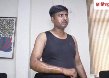 ग्वालियर में बिजली बिल चेक करने पहुंचे कर्मचारी के साथ बर्बरता, बंधक बनाकर पीटा; कुत्तों से भी कटवाया, Madhya-pradesh Hindi News
