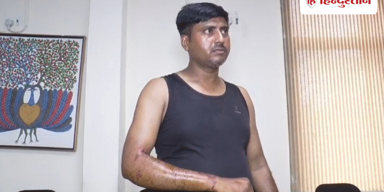 ग्वालियर में बिजली बिल चेक करने पहुंचे कर्मचारी के साथ बर्बरता, बंधक बनाकर पीटा; कुत्तों से भी कटवाया, Madhya-pradesh Hindi News