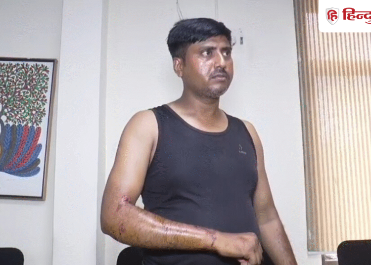 ग्वालियर में बिजली बिल चेक करने पहुंचे कर्मचारी के साथ बर्बरता, बंधक बनाकर पीटा; कुत्तों से भी कटवाया, Madhya-pradesh Hindi News