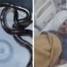 बिस्तर में छिपे सांप ने पुलिसकर्मी को दो बार डंसा, AI की मदद से समय पर मिला इलाज, Madhya-pradesh Hindi News
