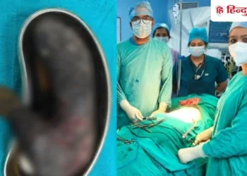 14 साल की लड़की को लगातार हो रही थी उल्टी, पेट में झांका तो डॉक्टर को पता चली अनजानी गलती, Shivpuri Hindi News